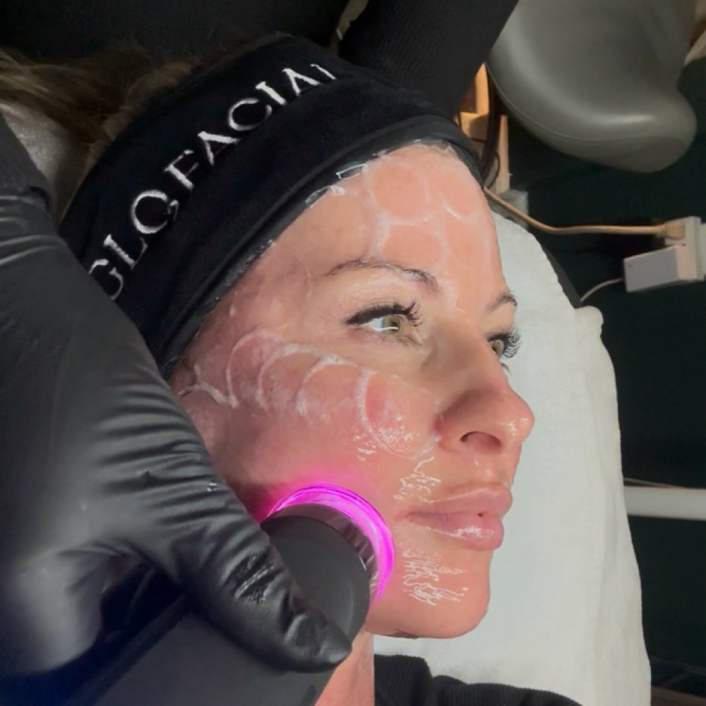 Glo2facial Lite at Skin Deep Aesthetics in Forest Lake, MN