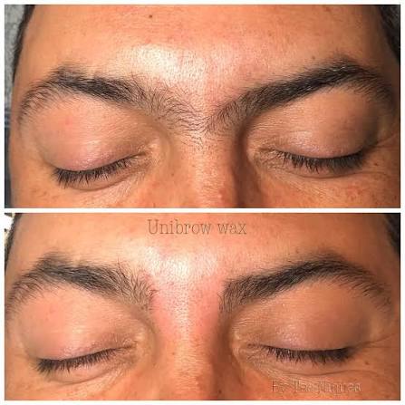 Unibrow Wax