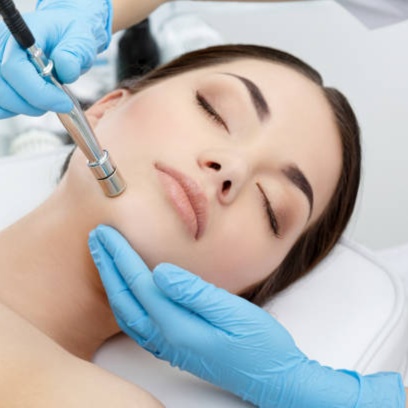Microdermabrasion Facial