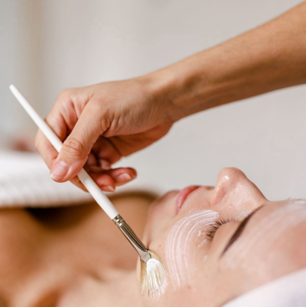 TCA Peel at Bare Beauty Wax & Skin in Loveland, CO