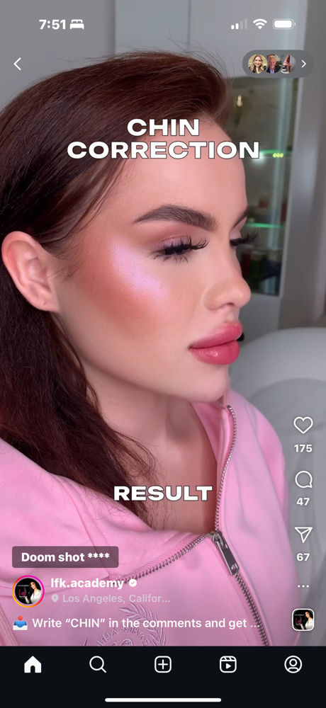 Threads at Gretchen Caldwell NP Integrative Aesthetic Wellness in Springfield, IL