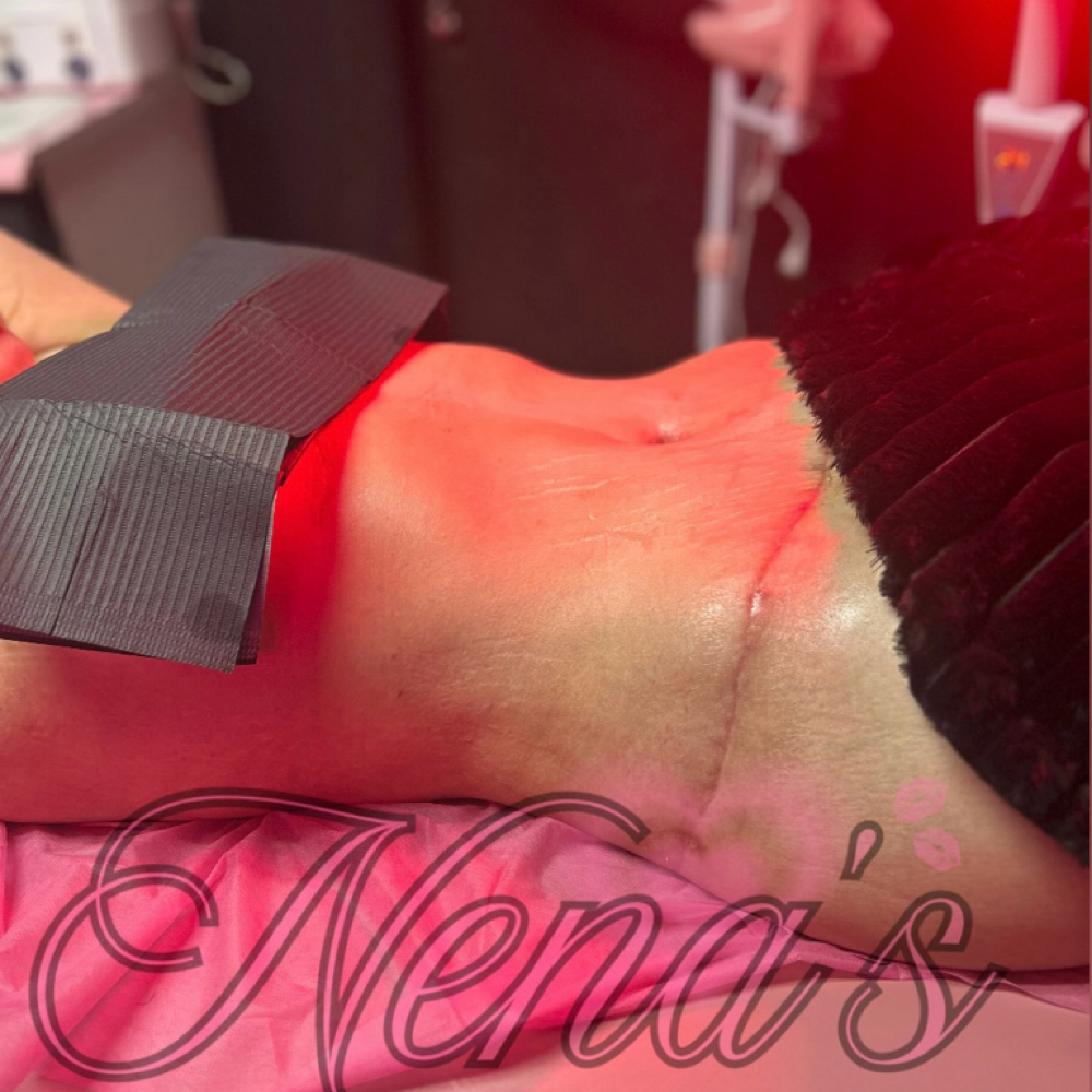 ✨PostOp Glow Touch✨Lipo/BBL/TummyT at Nena’s Beauty Glow Bar in North Las Vegas, NV