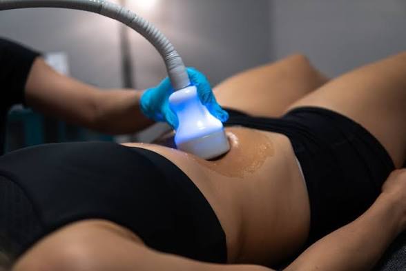 Cryoskin cryoslimming treatment