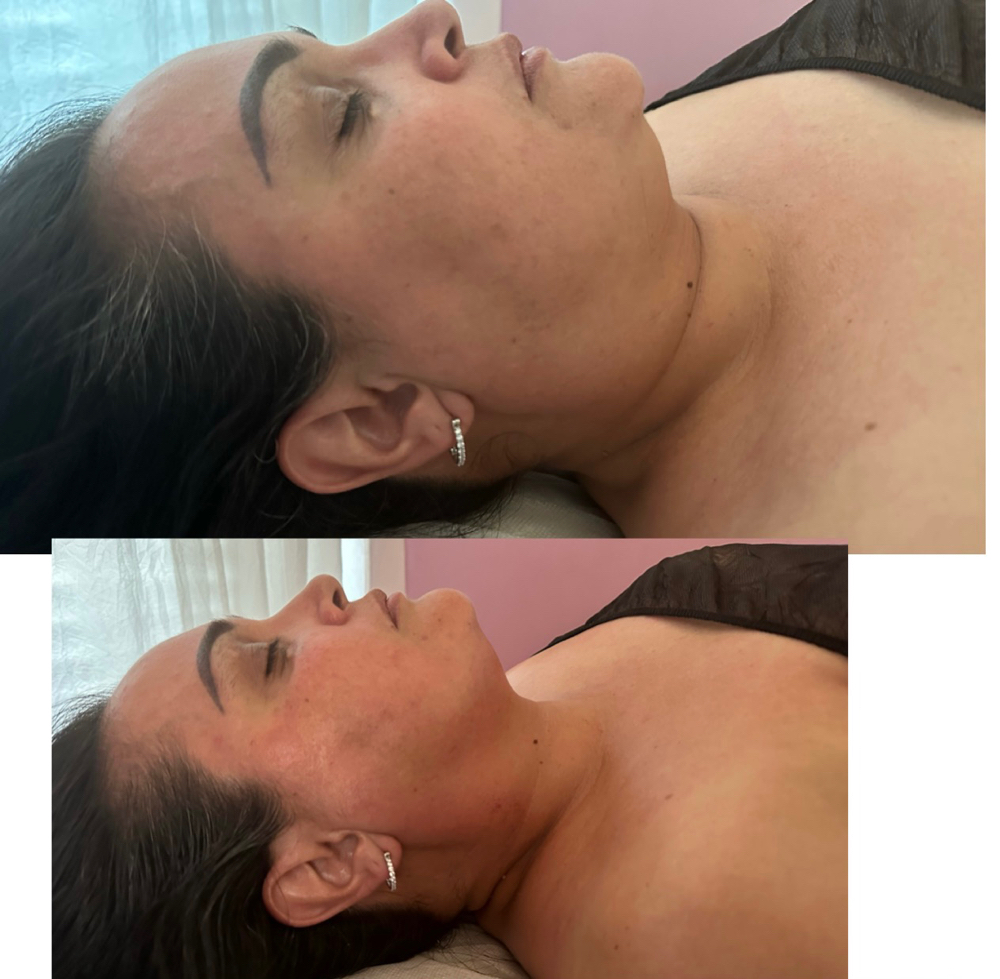 Facial Harmonization