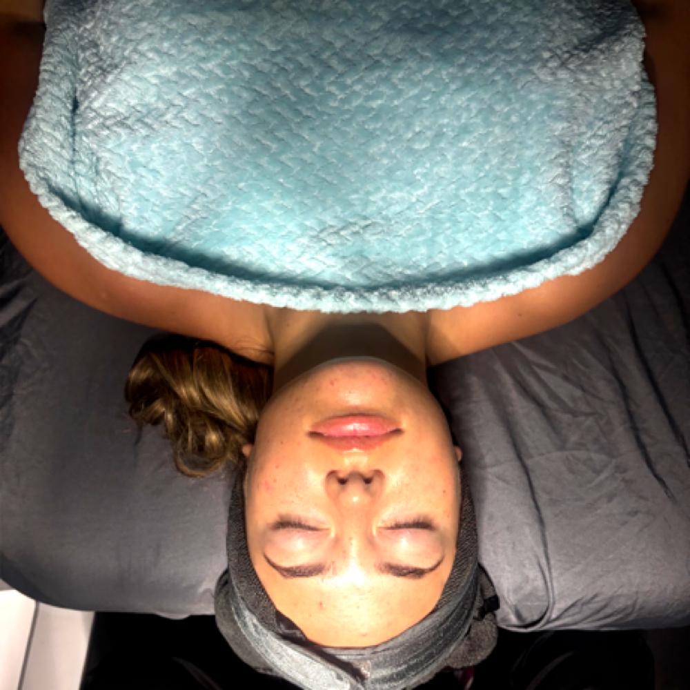 Chemical Peel Or Enzyme Facial at Face to Face Esthetics in Fort Oglethorpe, GA