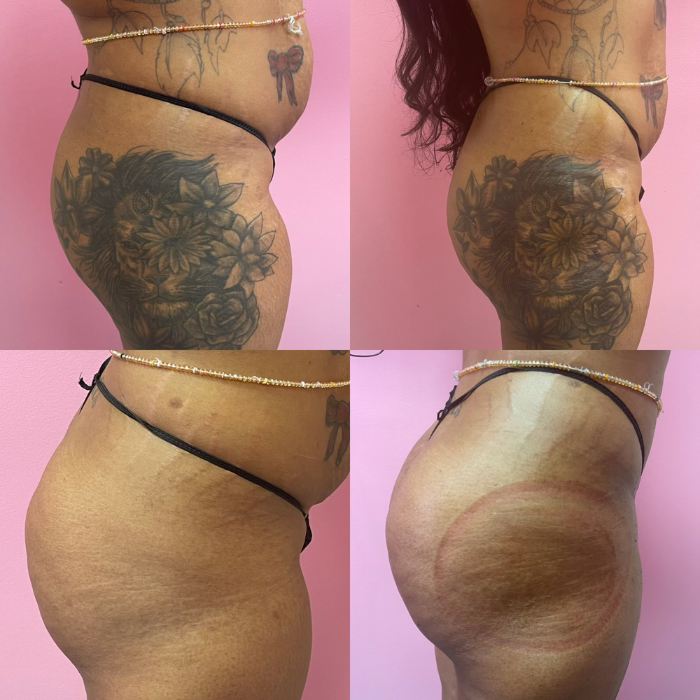 Full body enhancement