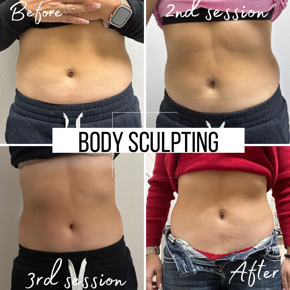 Body Sculpting (3 sessions)