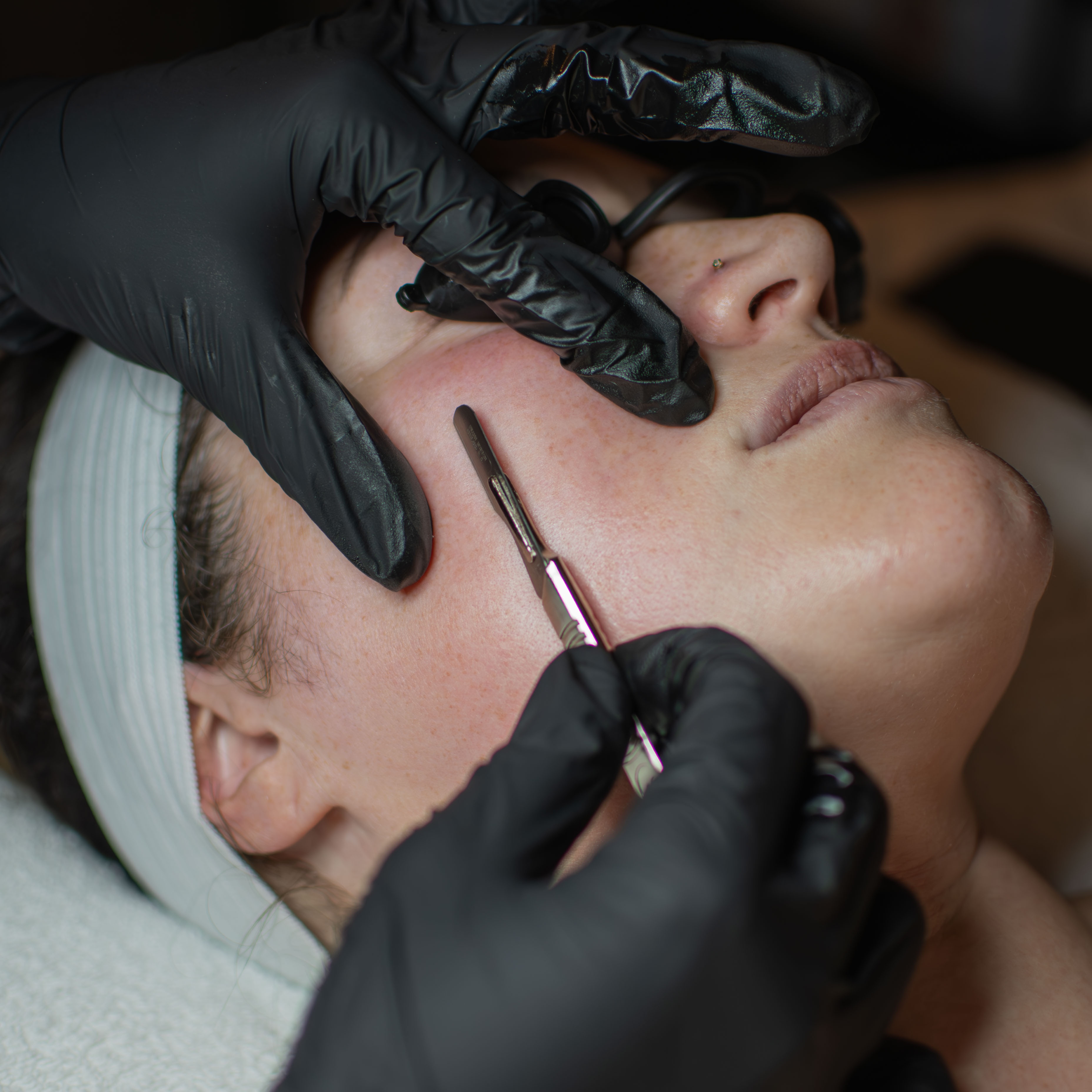 Peachy Glow Dermaplane Facial at Metamorphix Skin in Gaithersburg, MD