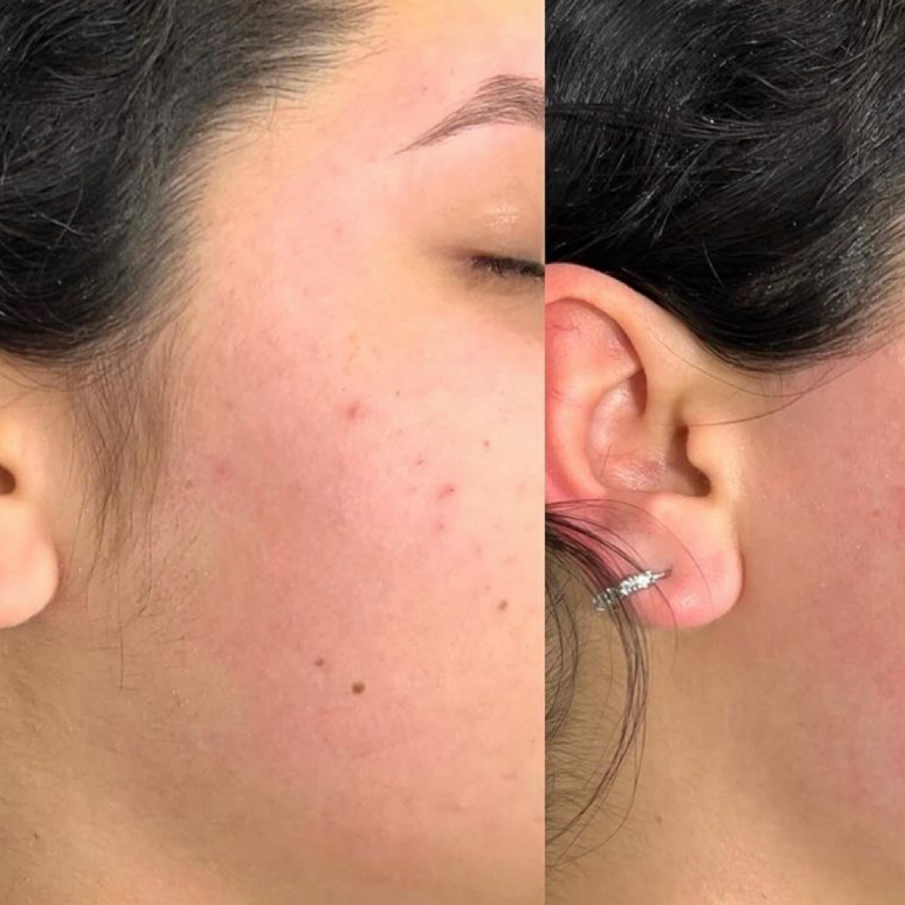 Side Burns at Atlas Beauty Haven in Brownsville, TX