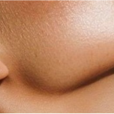 KLIFT | Face + Neck | x1 at KSCULPT in Louisville, KY