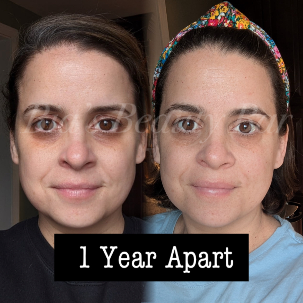 Undereye Lightening Tattoo at Bia's Beauty Bar in Buffalo, NY