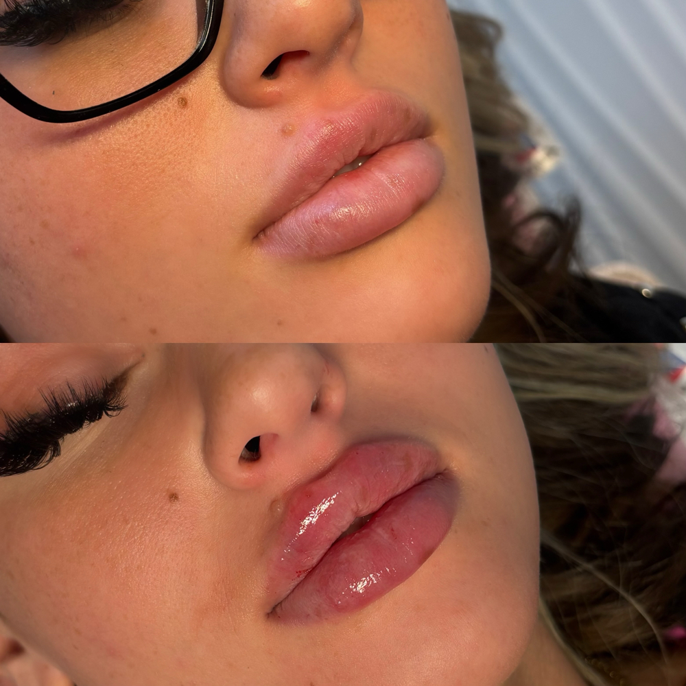 1.2ml Nano at Bodiedcosmeticss in Joliet, IL