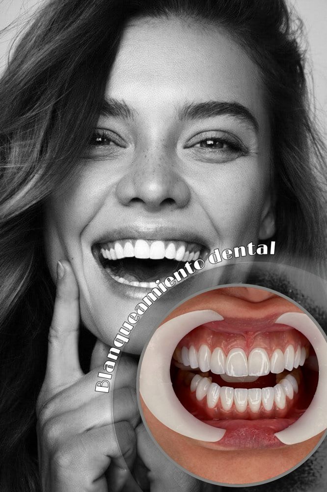 BLANQUEAMIENTO DENTAL 40 MINUTOS