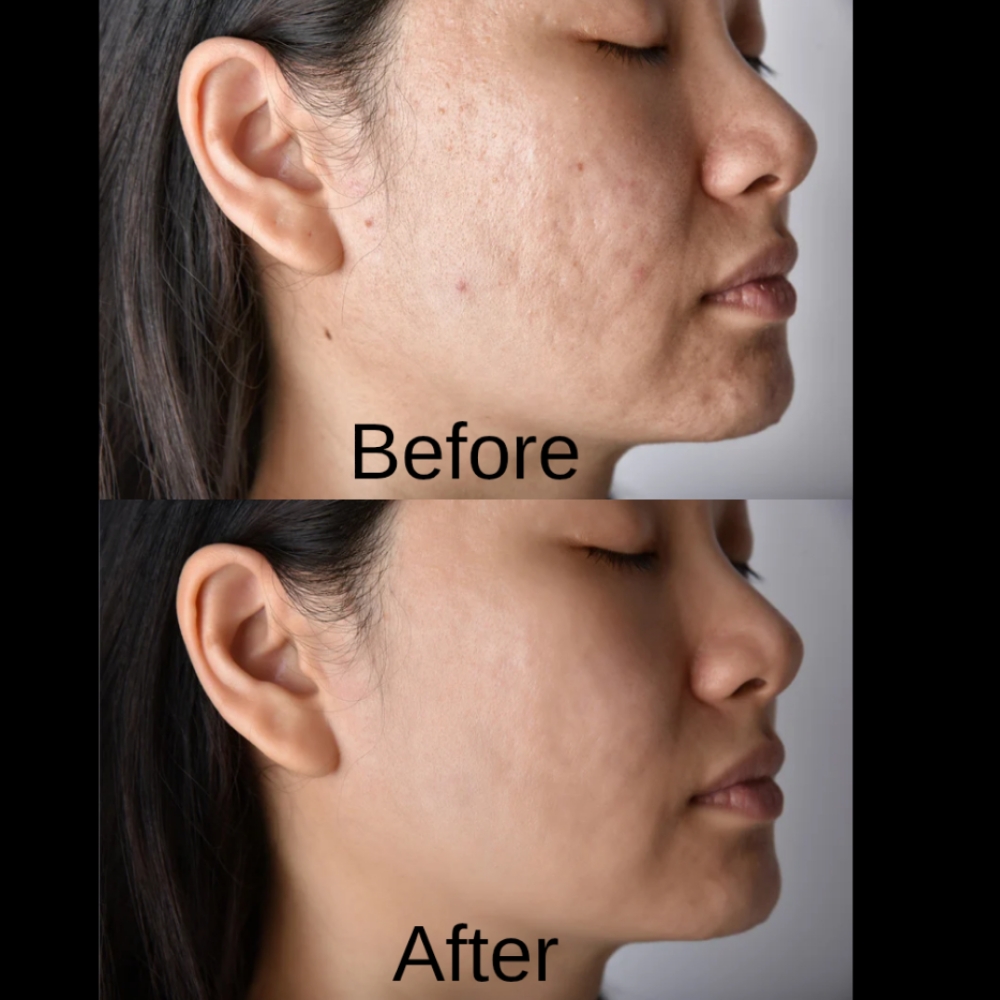 Anti-Aging Bundle at Skin by Bianca LLC in Gainesville, FL