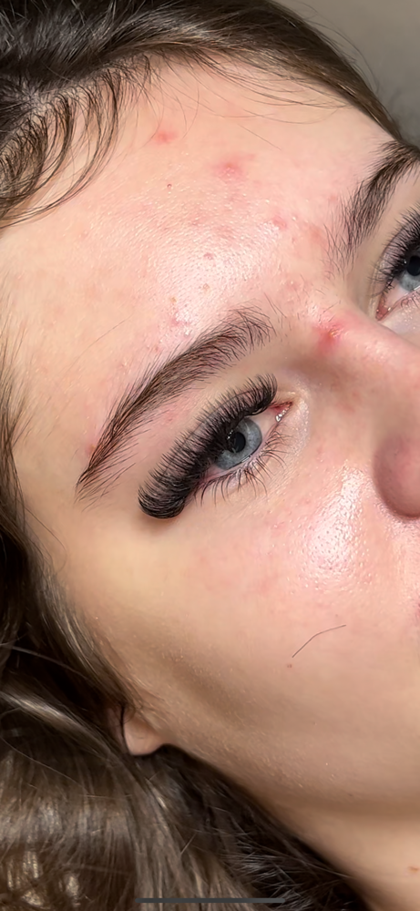 Hybrid mini fill