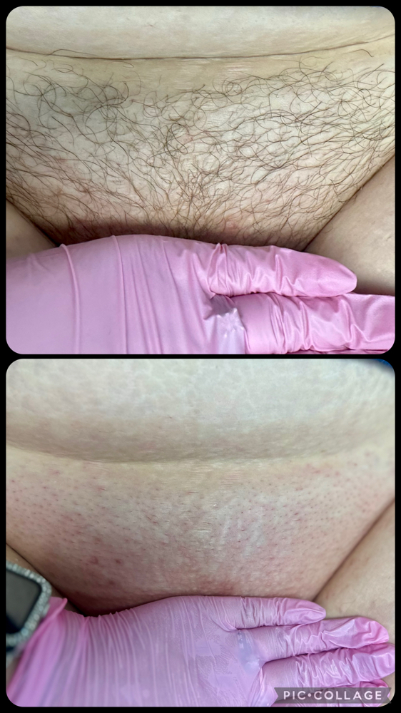 Women’s Brazilian Wax