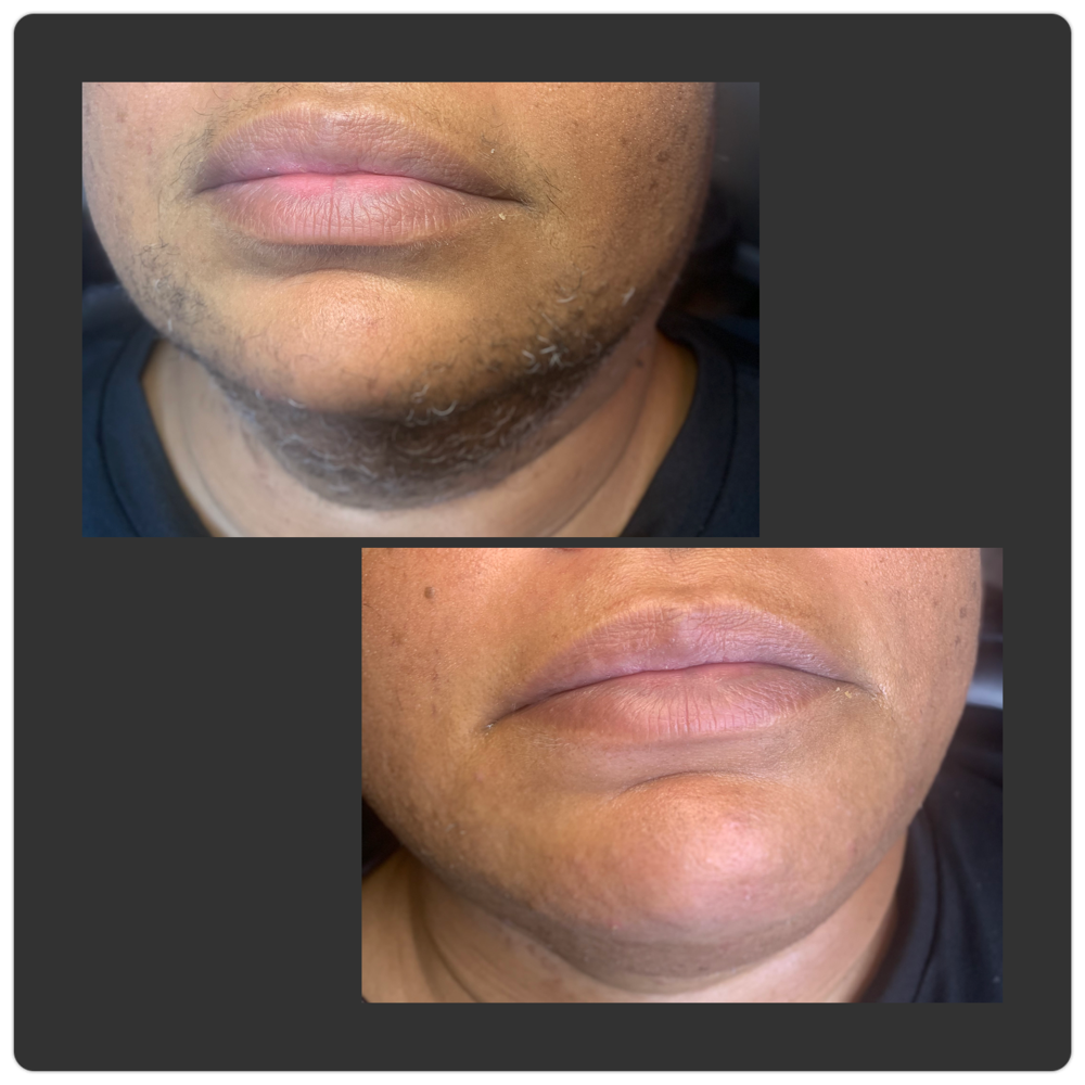 Upper Lip And Chin Wax at Dio Artistry in Louisville, KY