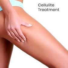 Body: Cellulite Single Treatment