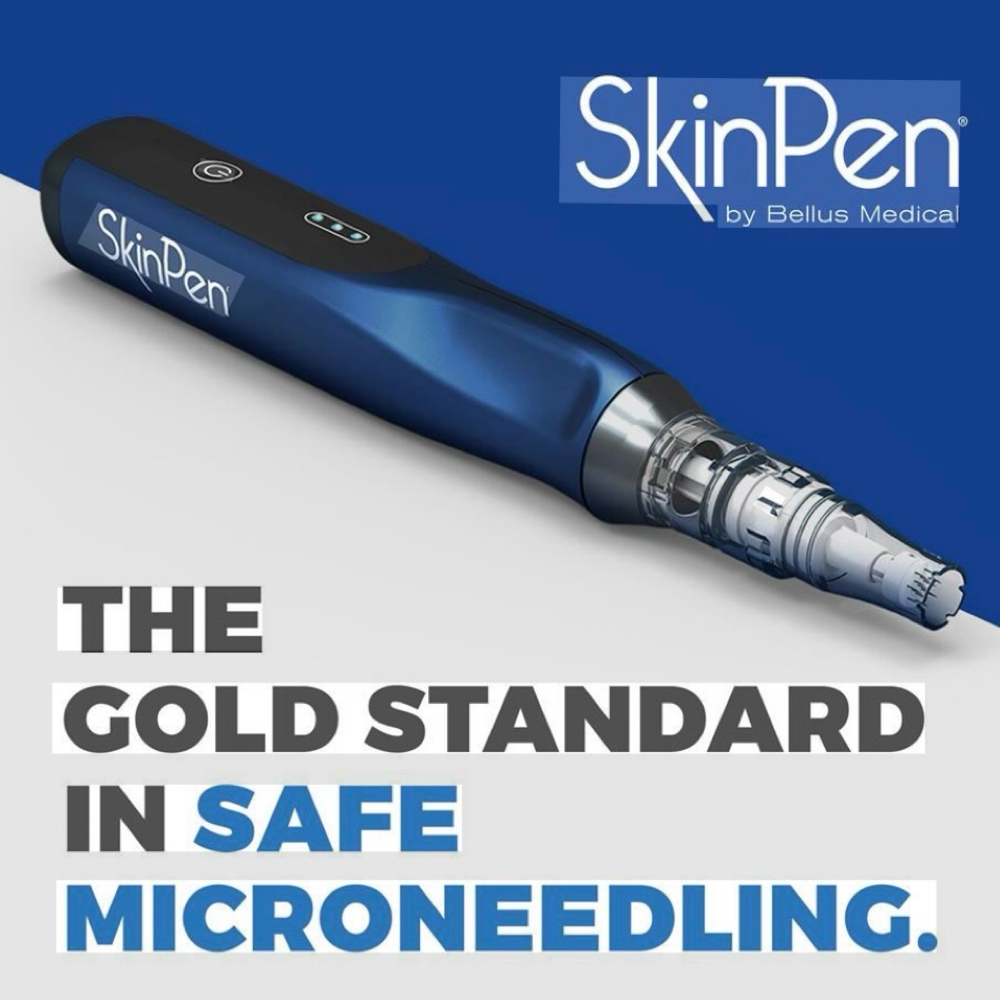 Microneedling Therapy at K Aesthetics in Cypress, TX