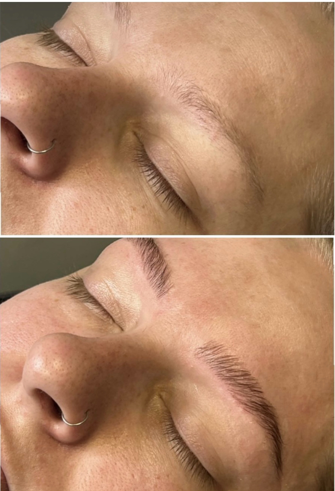 Brow Lamination/Patch Test Needed