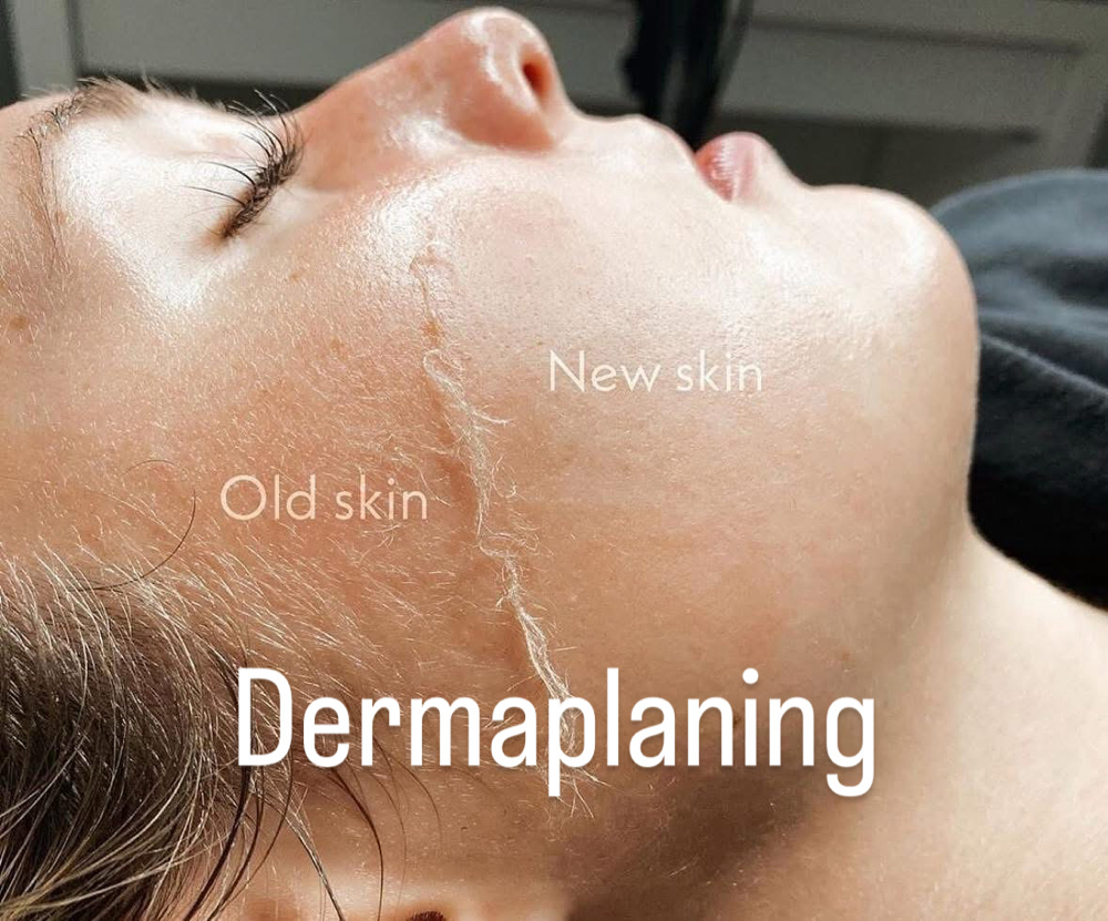 Dermaplaning