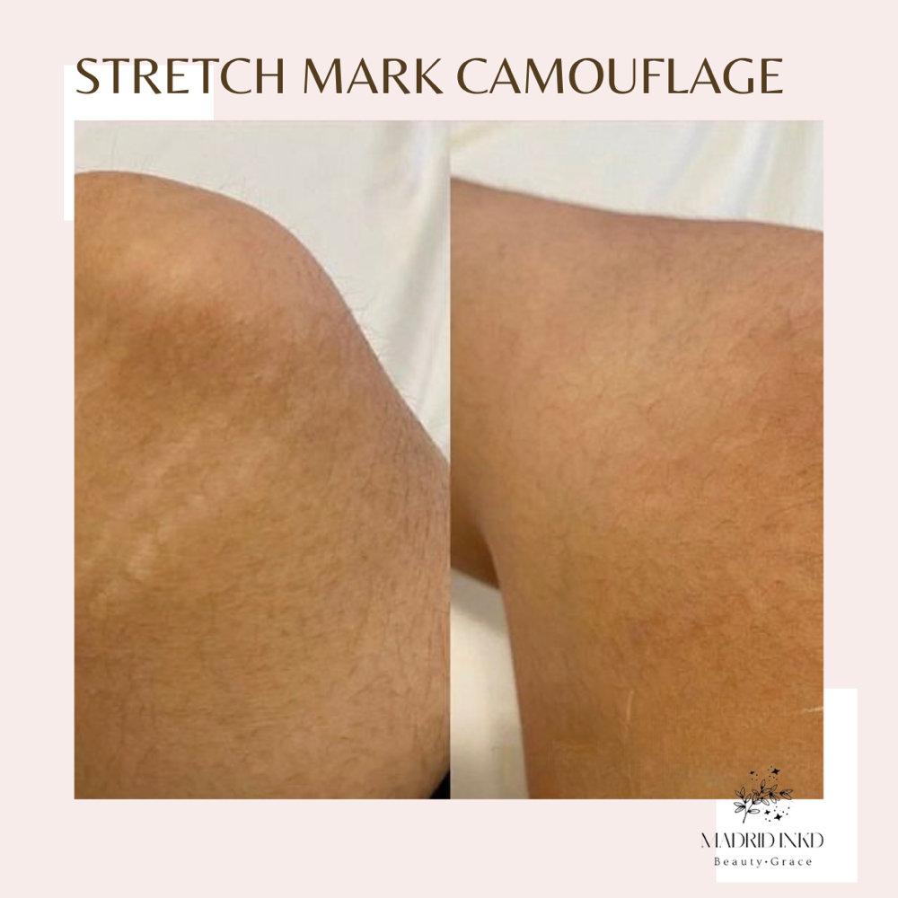 Stretch Mark Camouflage