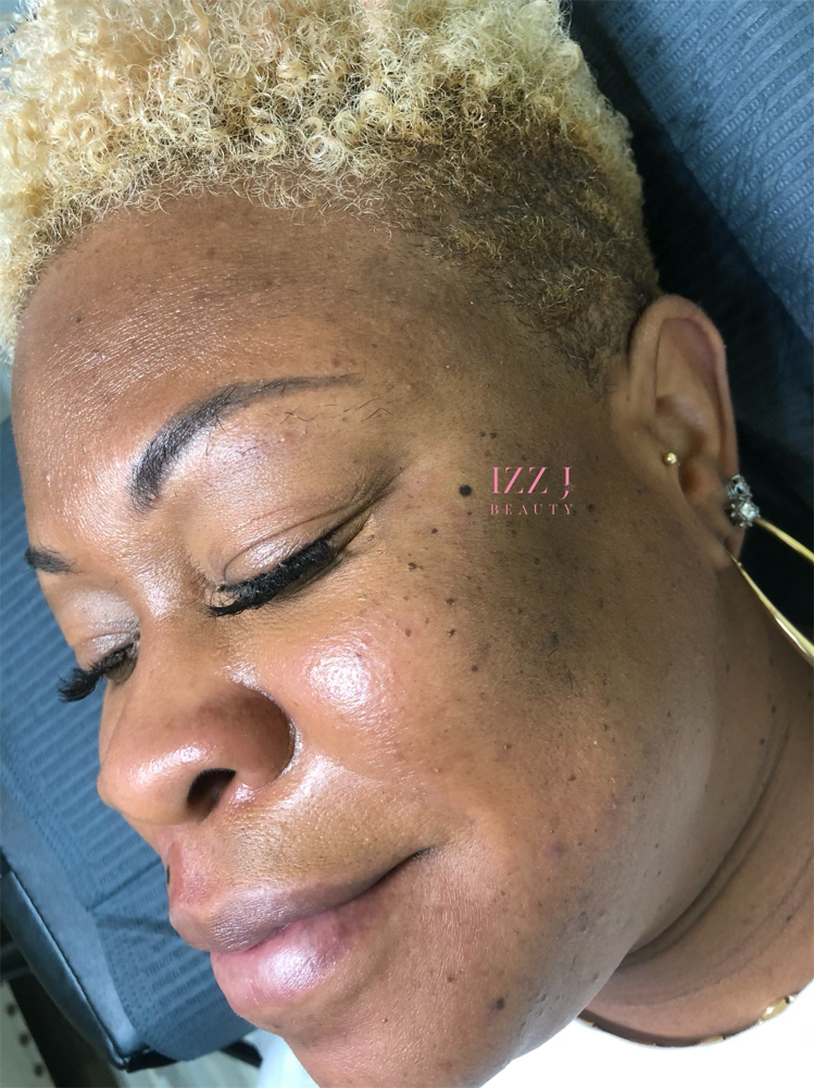 Beauty Marks