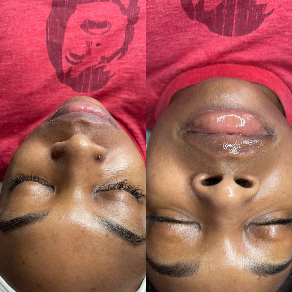 Enzyme Treatment