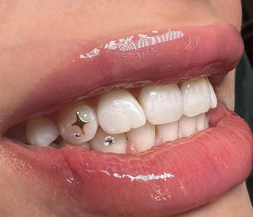 Tooth Gems
