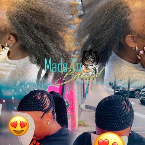 Hair Loss Ponytail