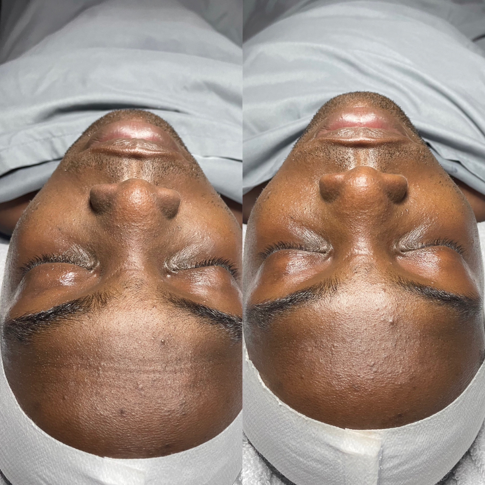 Gentlemen Facial at Reflections Within Spa in Sharpsburg, GA