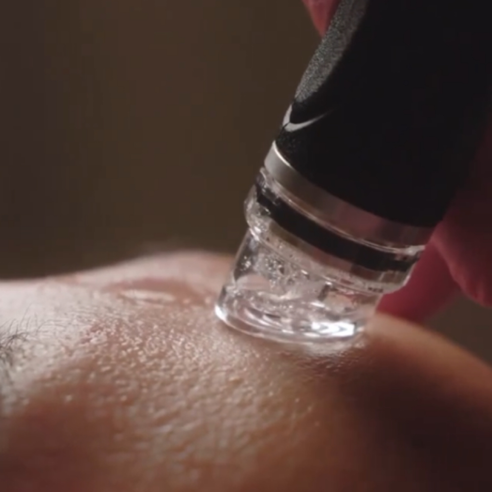 Express Hydrafacial at Northern Roots Salon and Spa in Norfolk, NY