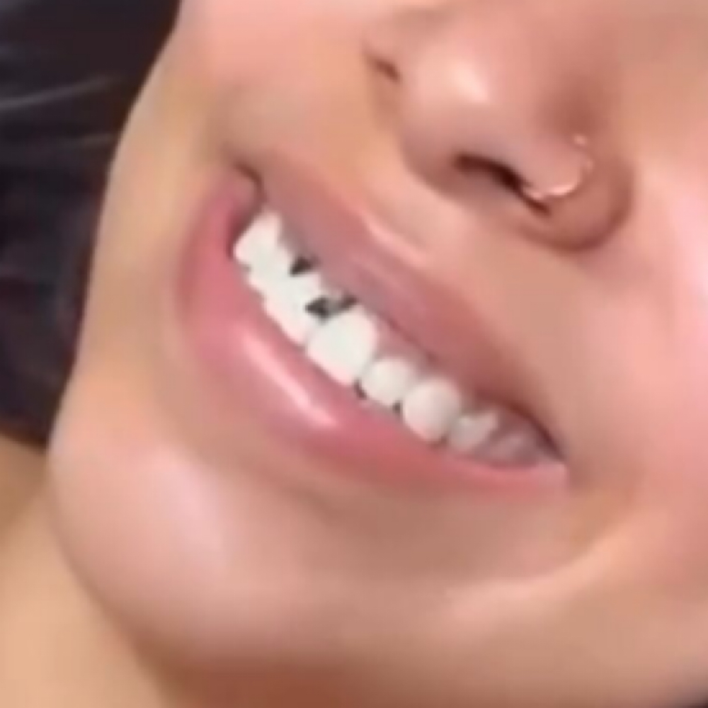 Teeth Whitening at Aurelia Headspa in Reading, PA