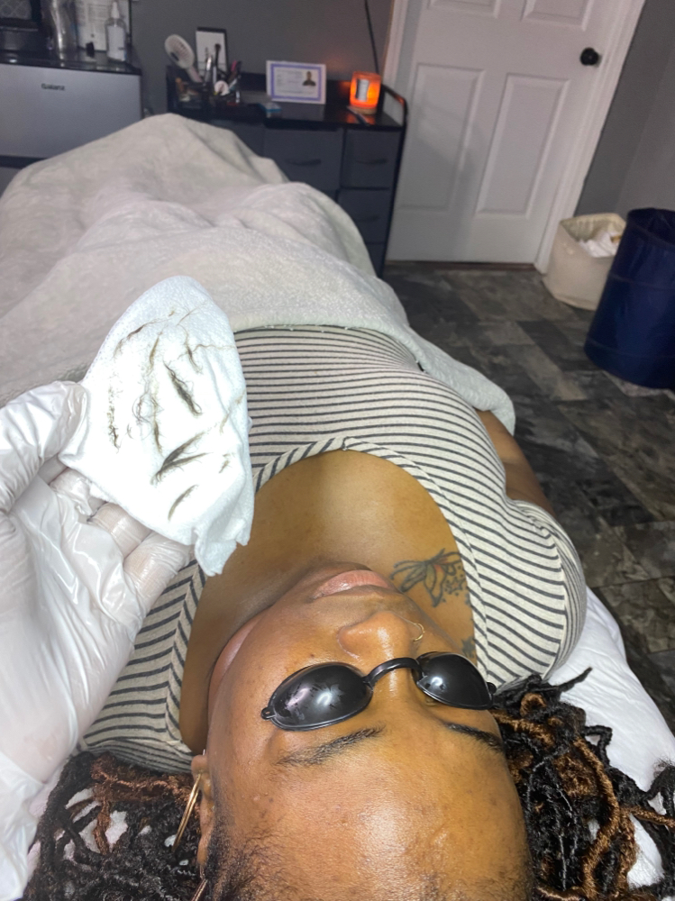 Dermal Planning Facial