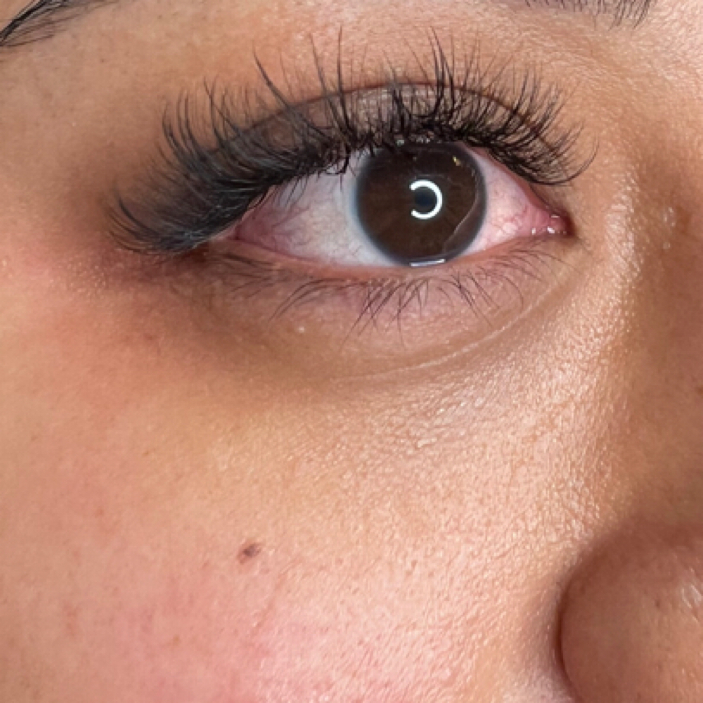 Foreign Refill at The Skin Room Aesthetic and Wellness  LLC in Longview, TX