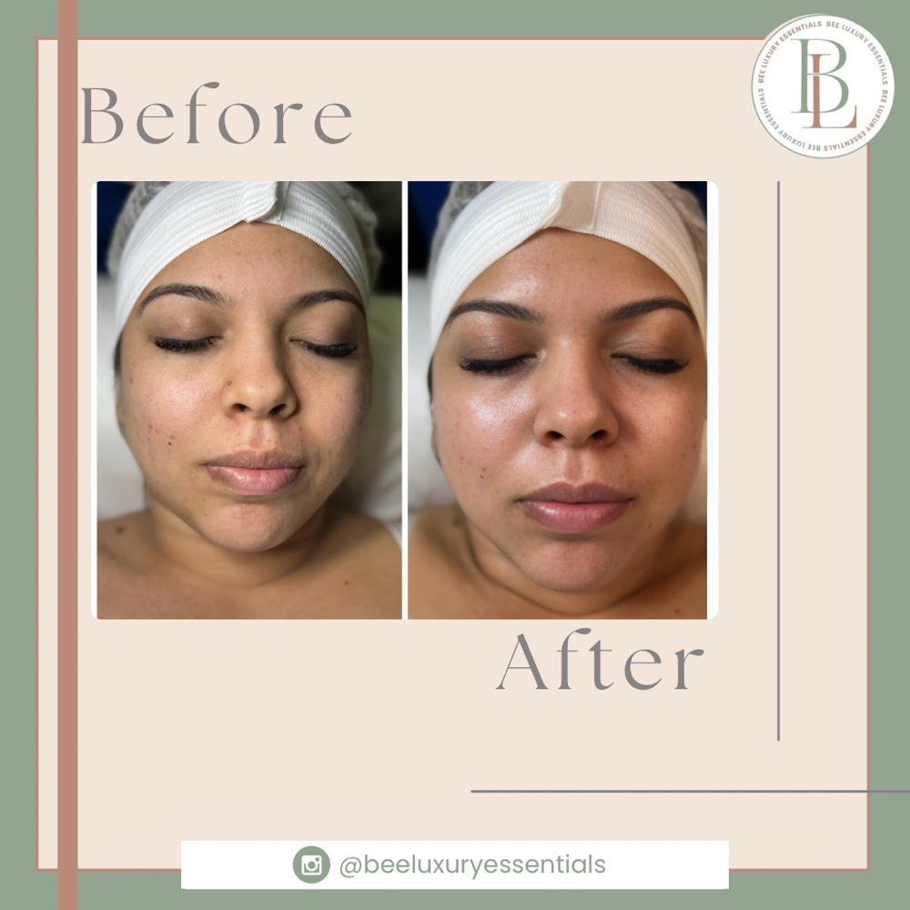 Essential Treatment 1