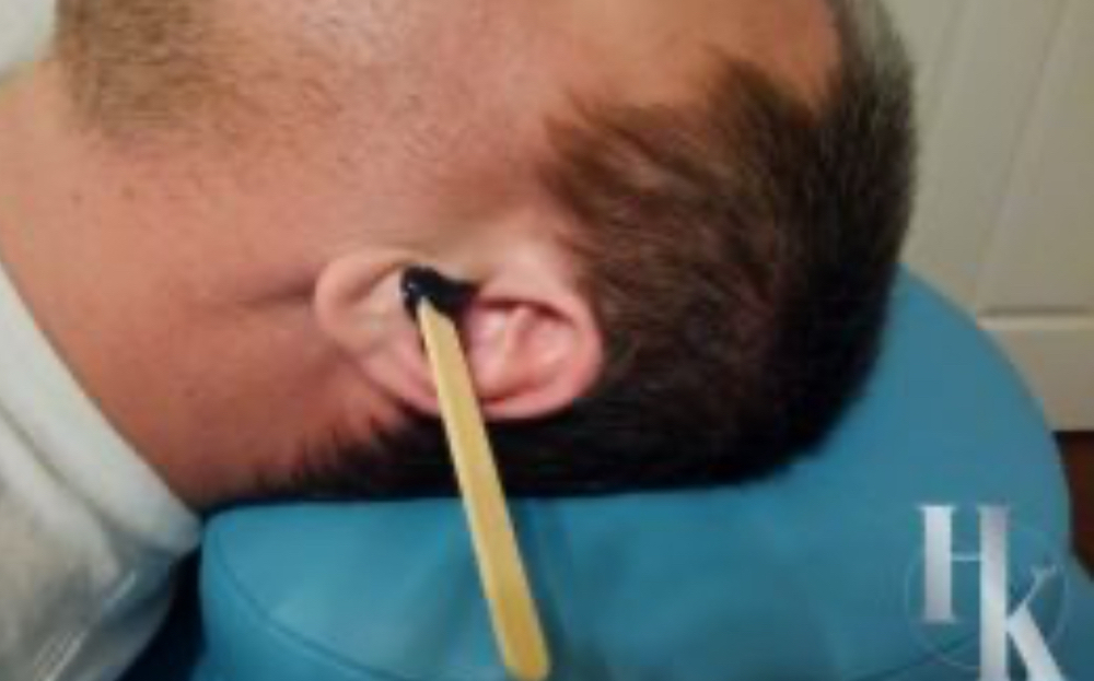Ear Waxing