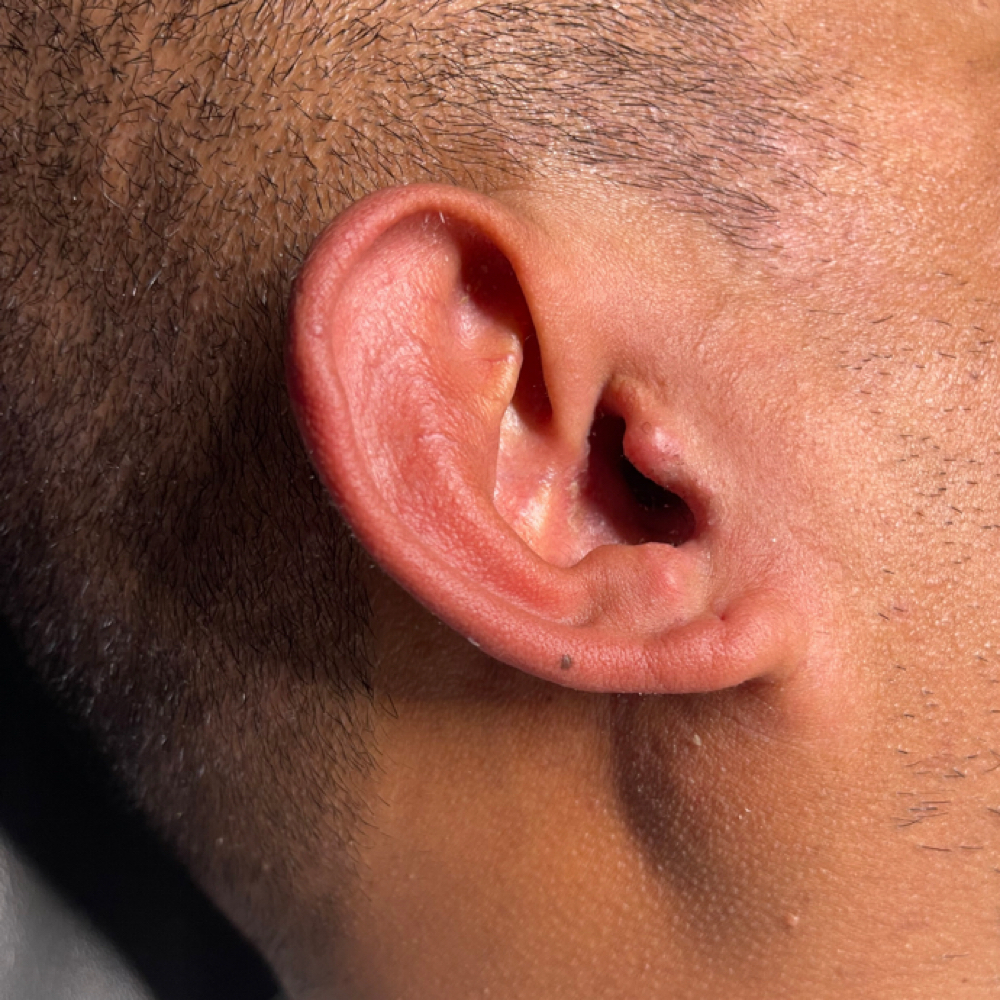 Ear Waxing at Radiance Aesthetics by Aracely in Bakersfield, CA