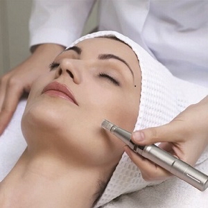 Microneedling