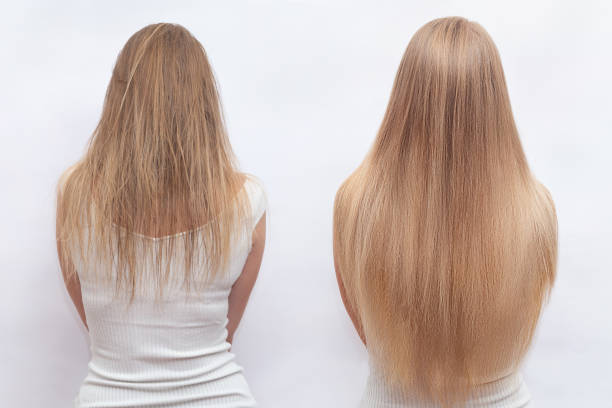Extensions