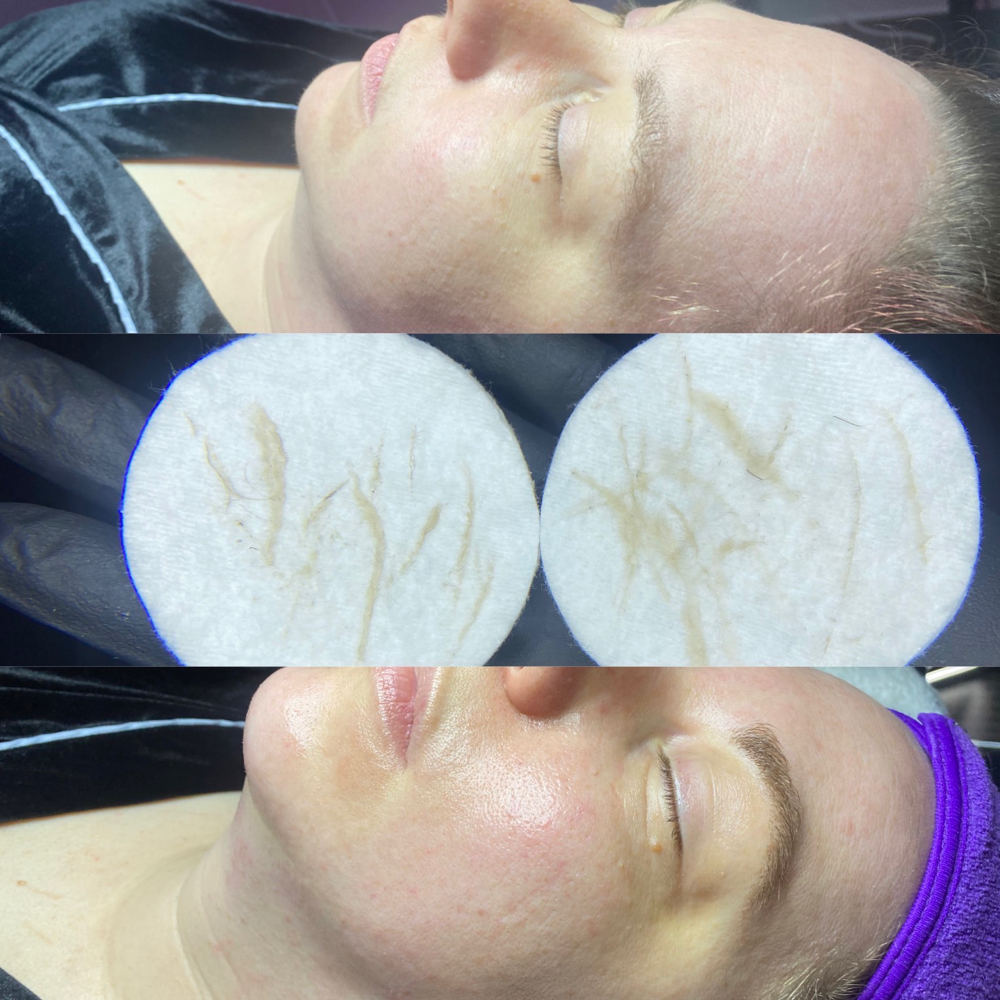 Dermaplaning *facial add on*