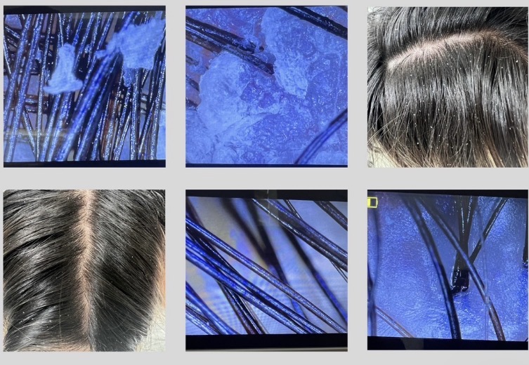Scalp Detox at ✨Luxxe Salon✨ in Greeley, CO