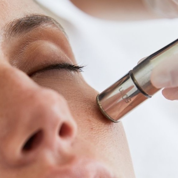 Diamond Micro-dermabrasion Facial at Mj Esthetics in Kirbyville, TX