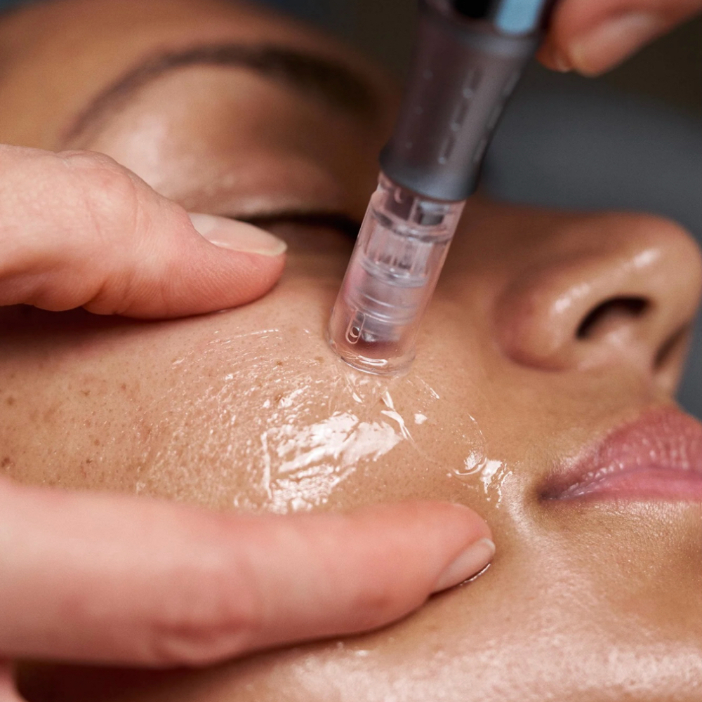 Nano-Infusion Add-On at The Beauty Well in Hillsborough, NC