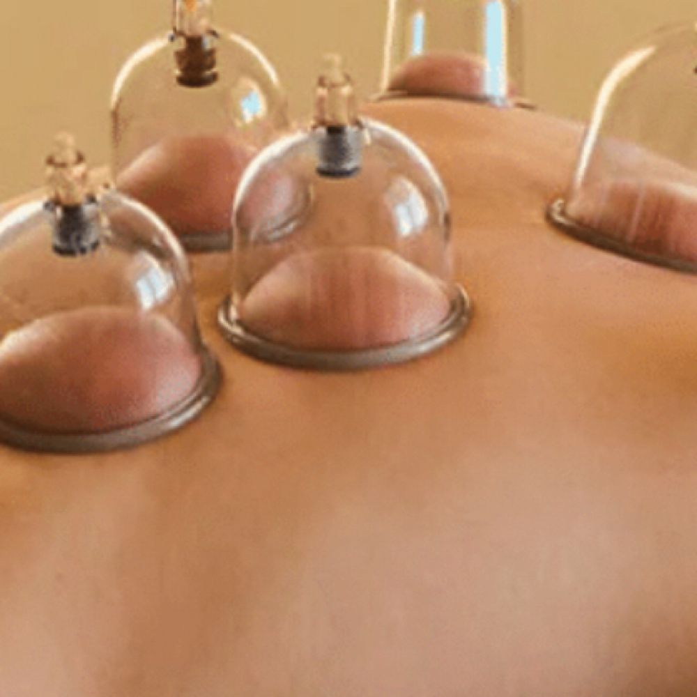 Cupping at Destined For Beauty LLC in Boone, IA