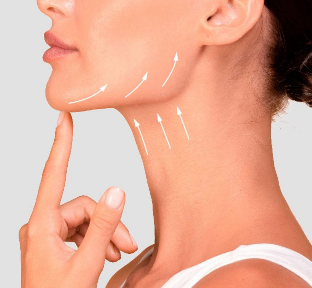 Neck Lift with Botox