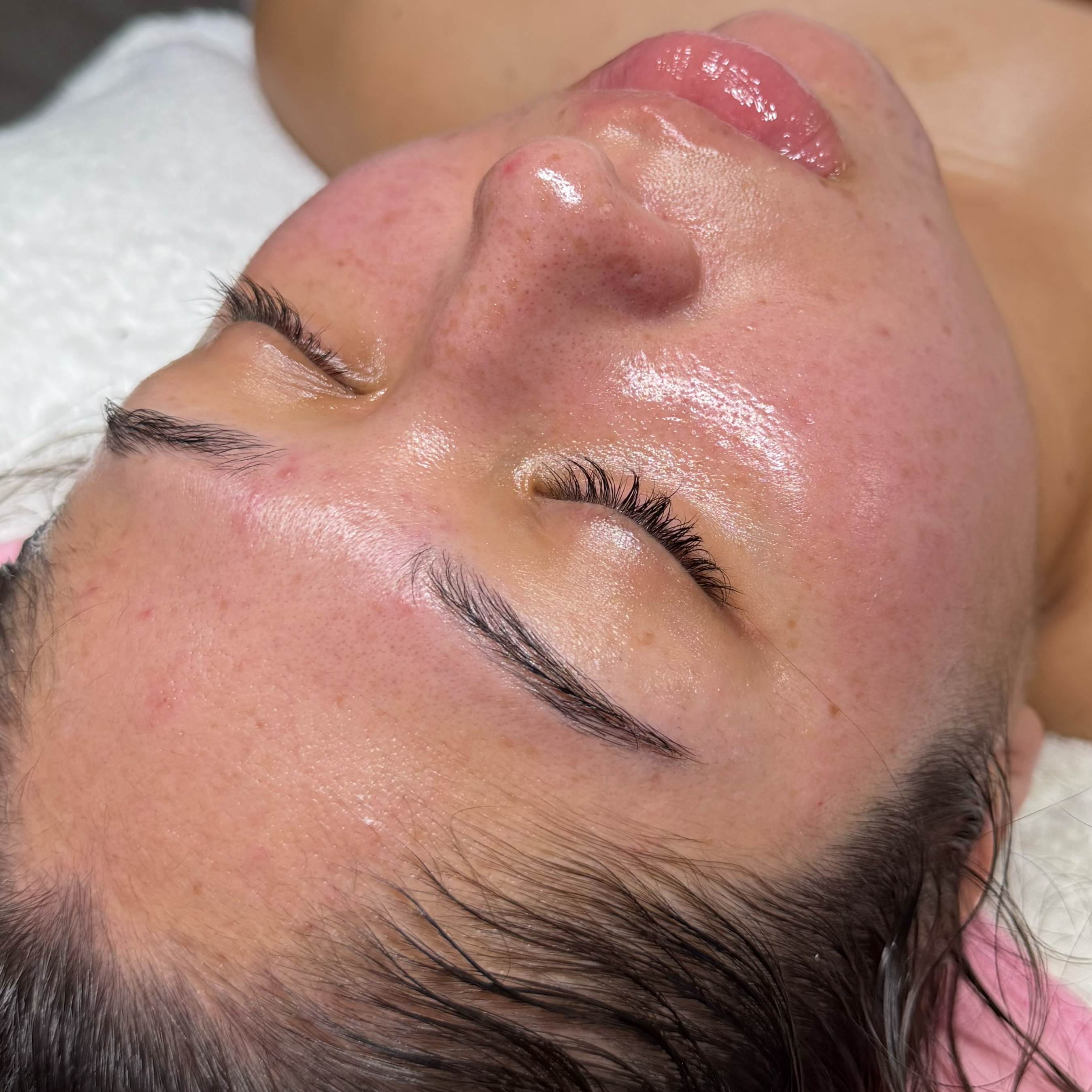 Sensitive/ Rosacea Skin Facial at HALO SKN ESTHETICS in Killeen, TX