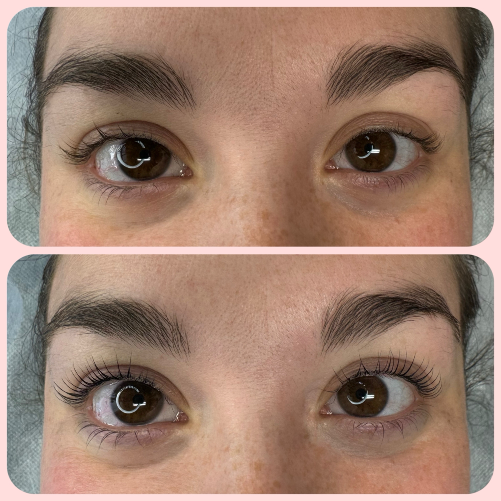 Lash Lift