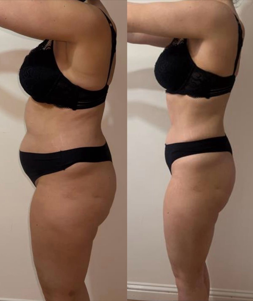 Body Shape 360 at Myp Skin & Body LLc in Columbia, MD