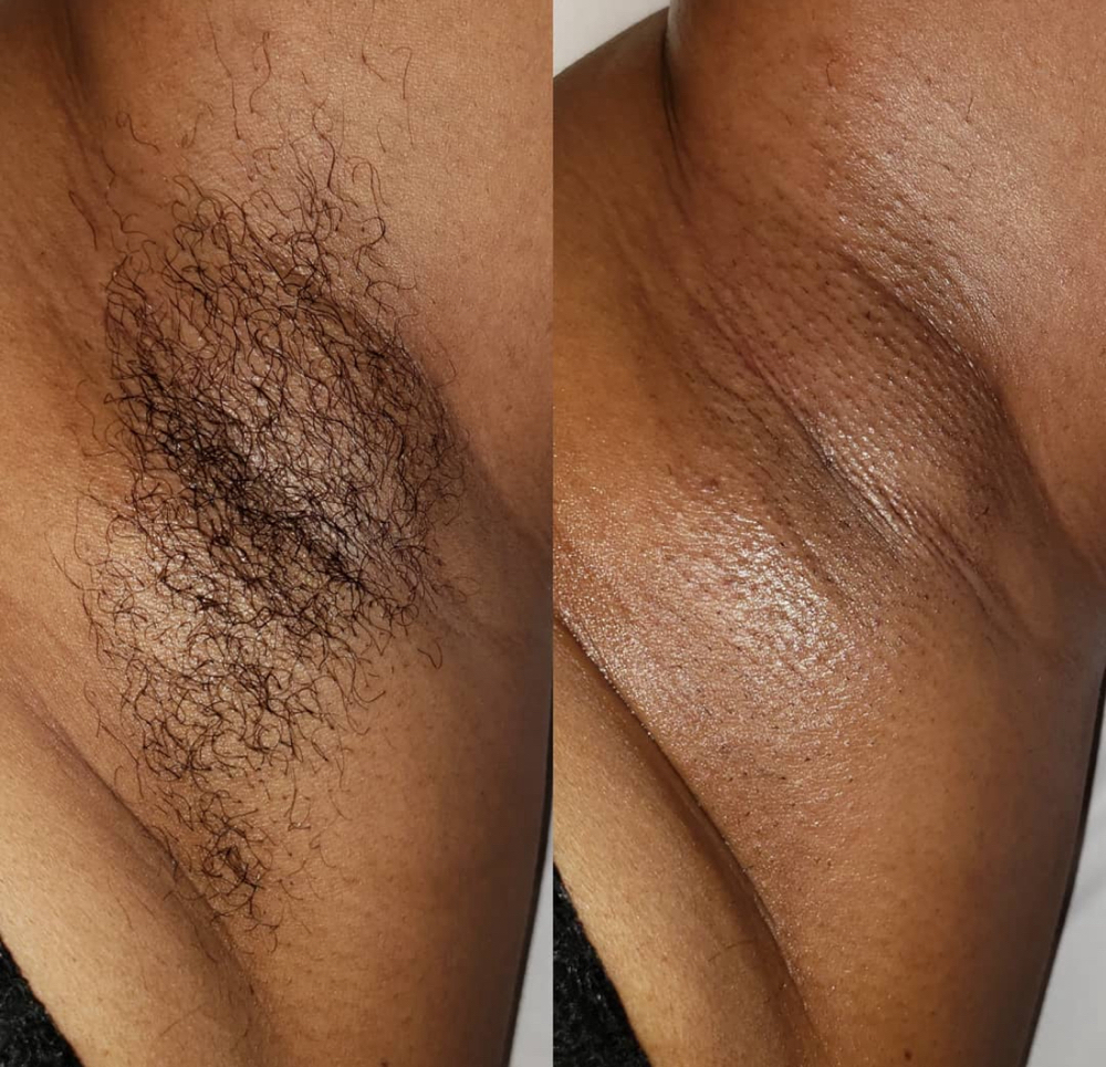 Under Arm